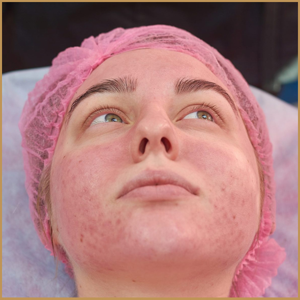 Benefits-of-Neuromodulators